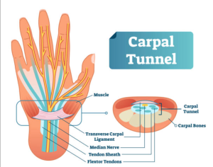 The Upper Cervical Connection